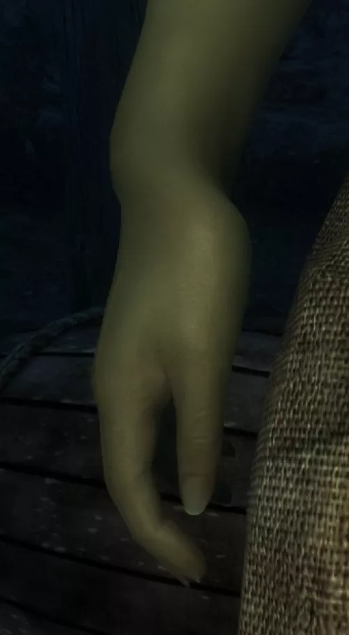 Broken wrists w/CBBE 3BA? Anyone know what's causing this?