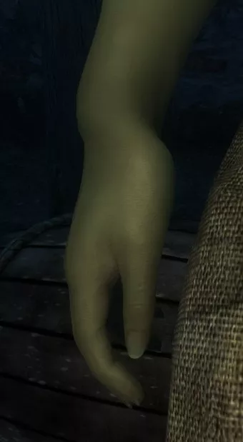 Broken wrists w/CBBE 3BA? Anyone know what's causing this?