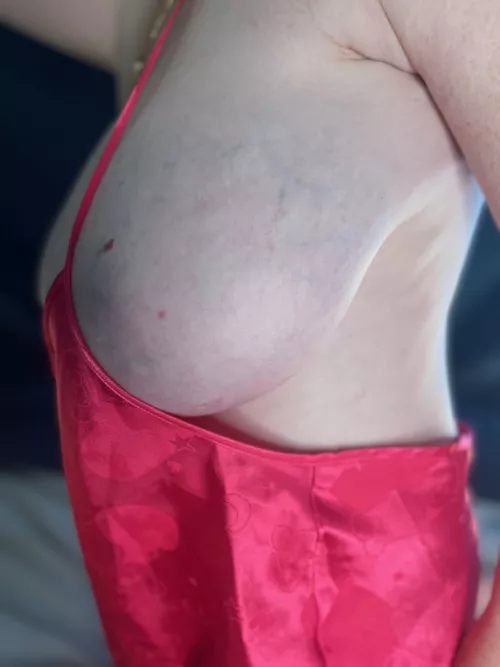 Bursting side boob