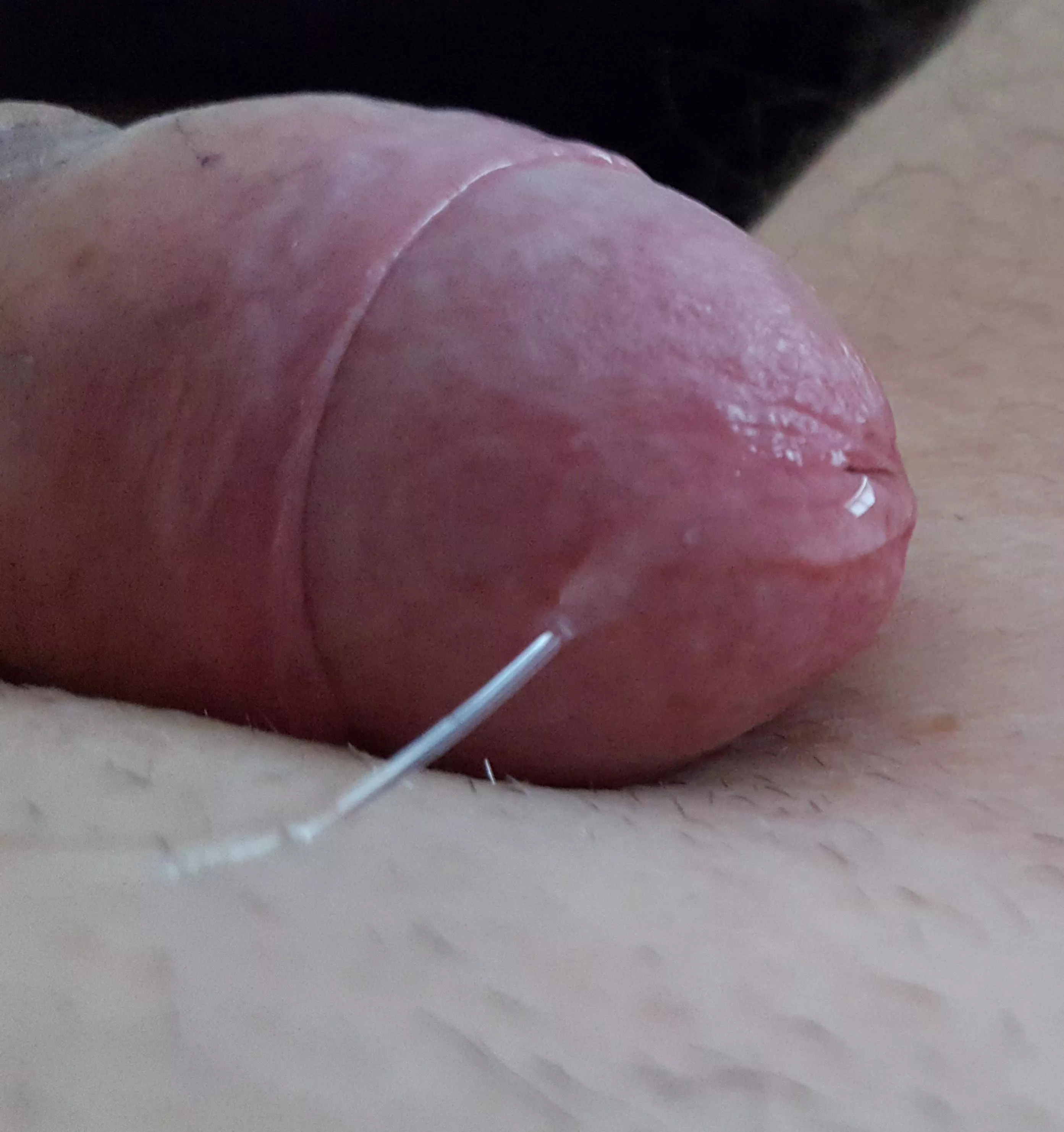 Came to a sticky end....