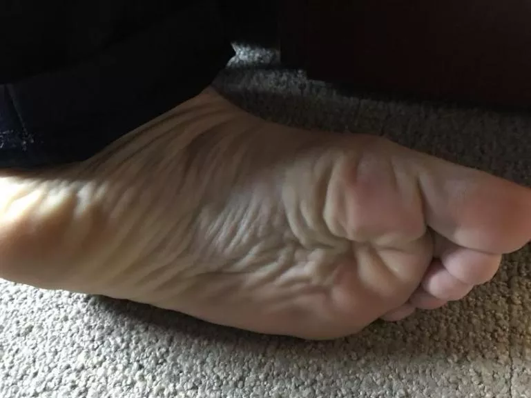Can you count the wrinkles? Can you count the wrinkles?