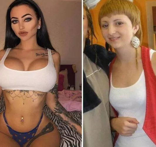 @Ccentino Celine Centino before & after %Β― perfec.t Insta: @GodTierPlastic