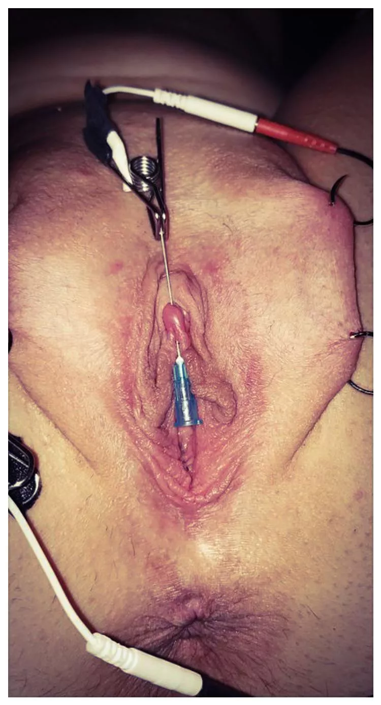 Clit in pain