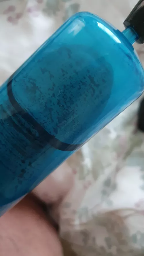 Coronal ridge in 360 degree contact. Not at end of tube yet, but do I need a bigger tube?