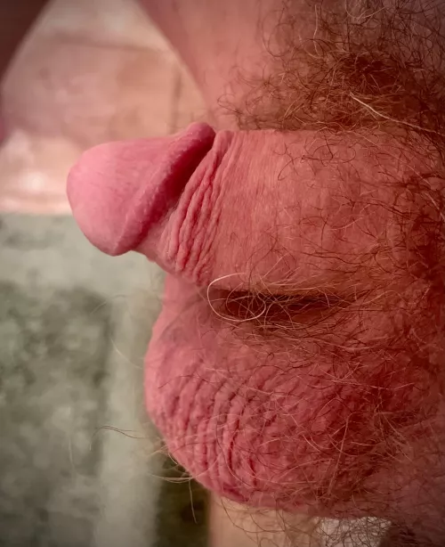 Current Situation [46]