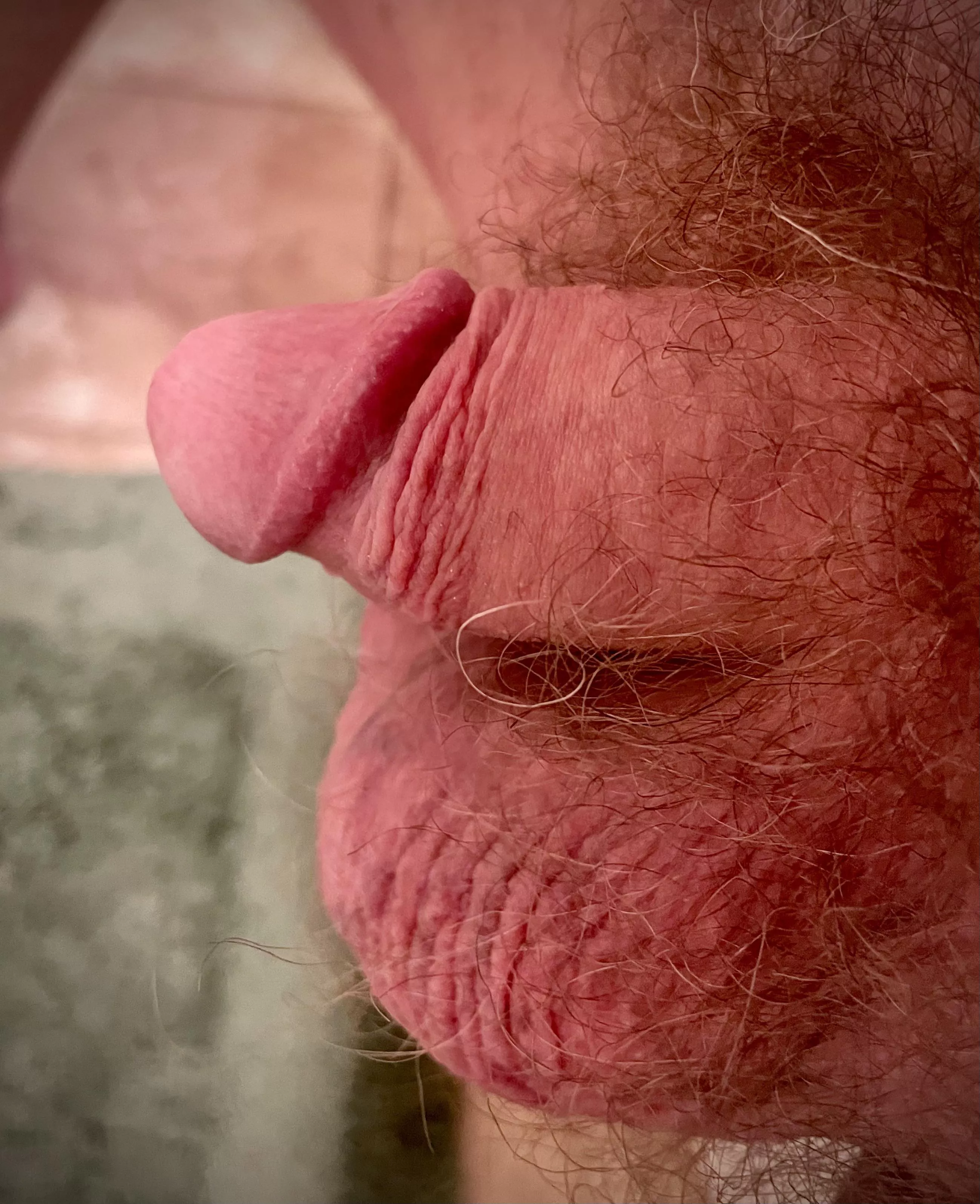 Current Situation [46]