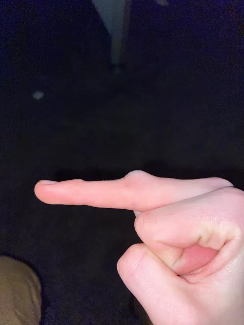 Damaged finger while drinking and listen to lynryd skynryd lmfaoo