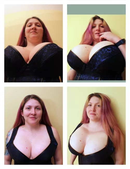 Demora after saline inflation. Can anyone expain me how this method actually work?