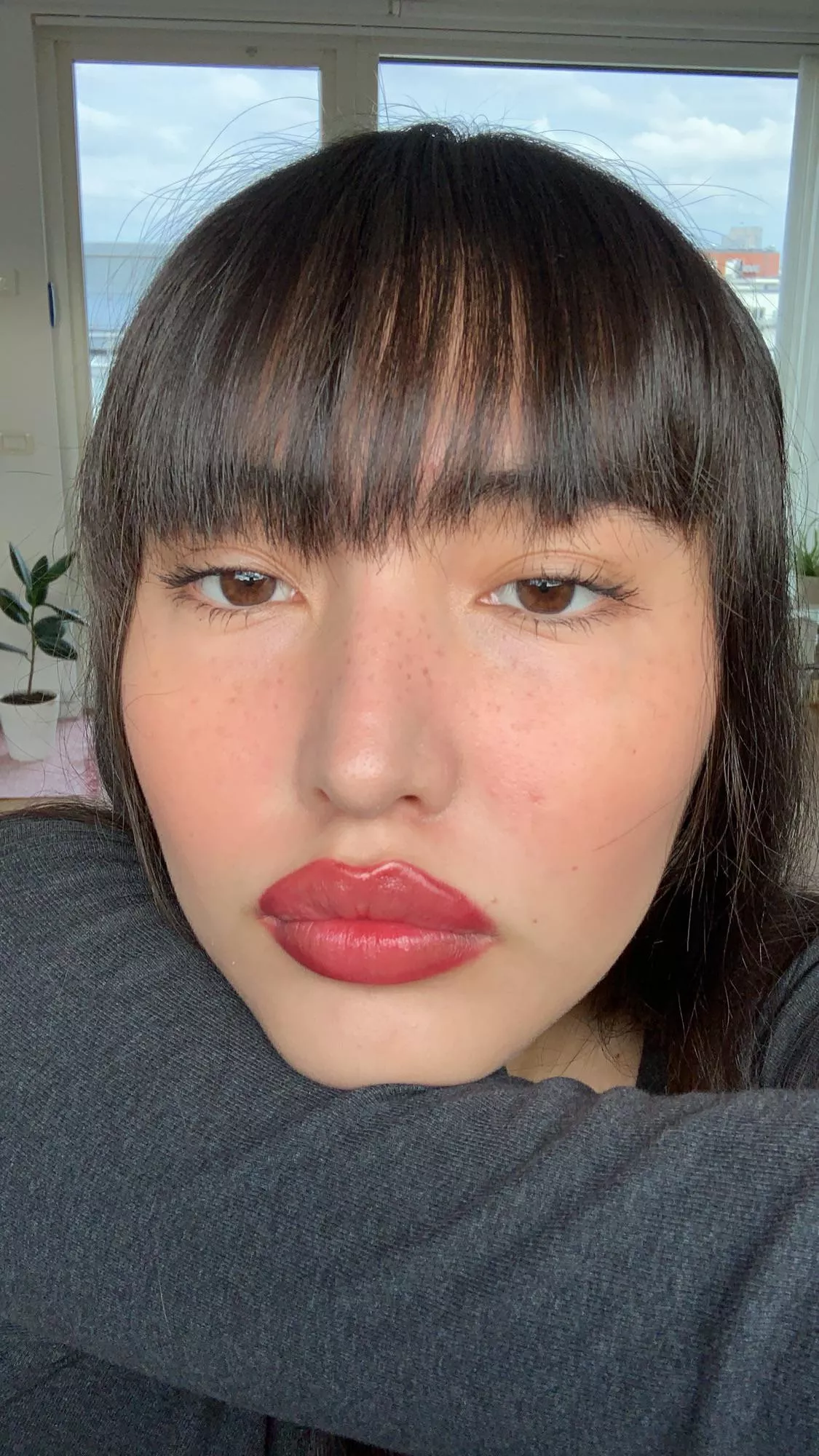 Do I have DSLs lips? What’s the veredict