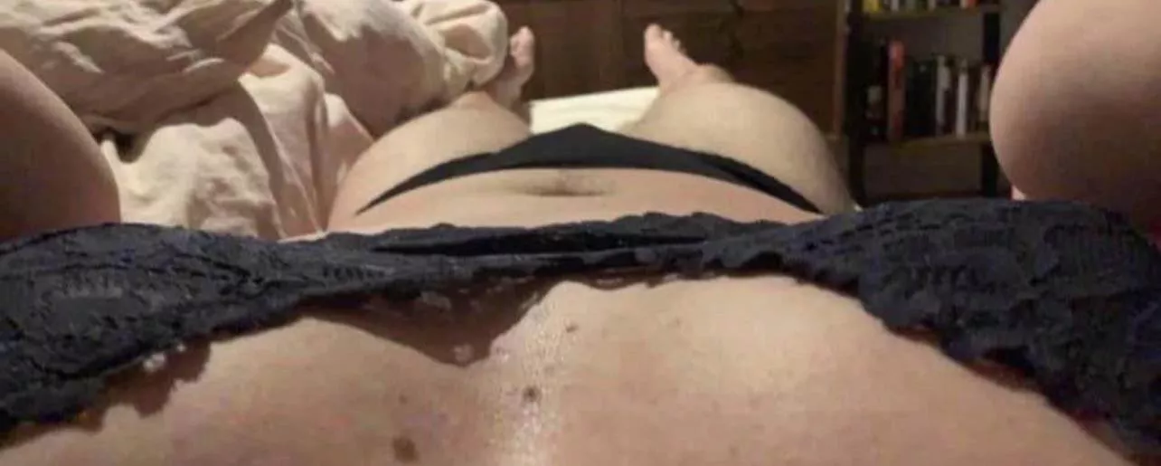 Do you like my freckles?