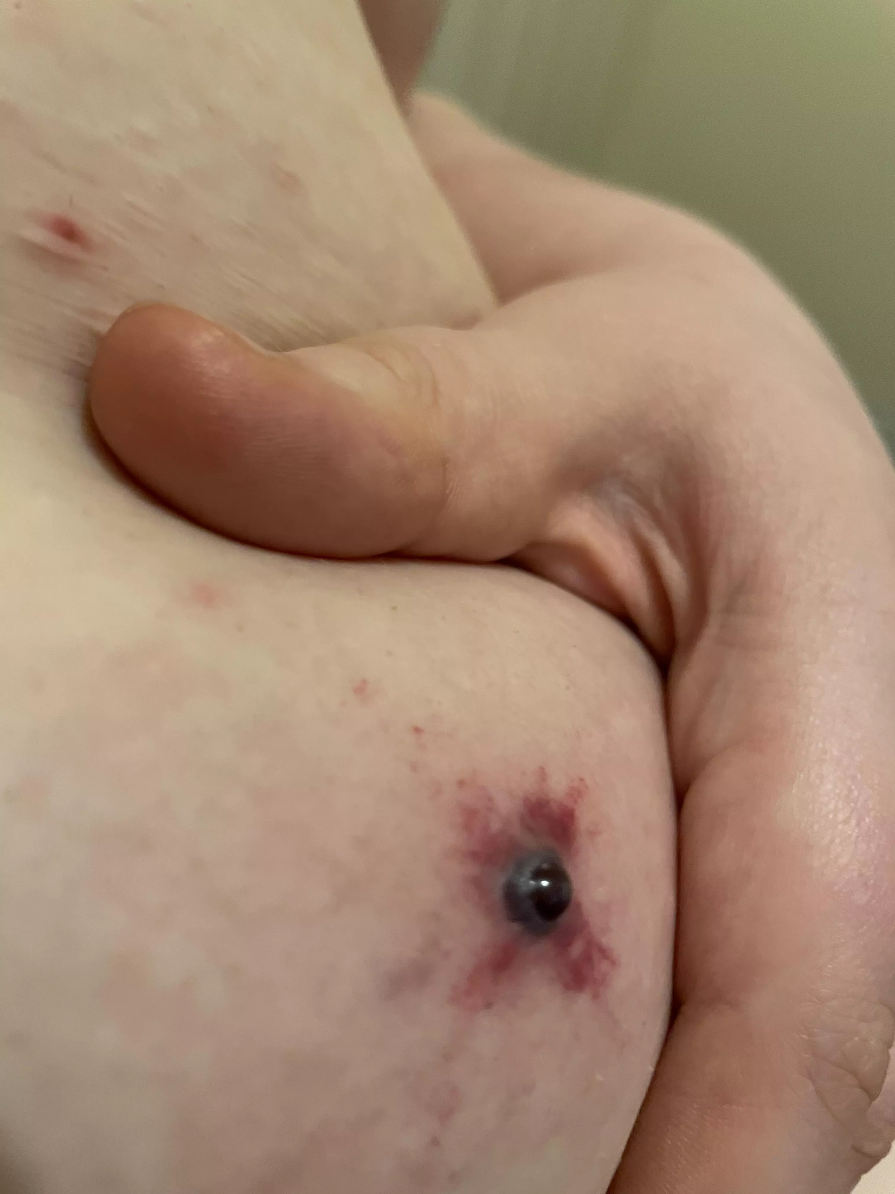 Does anyone else gets blood spots(?)