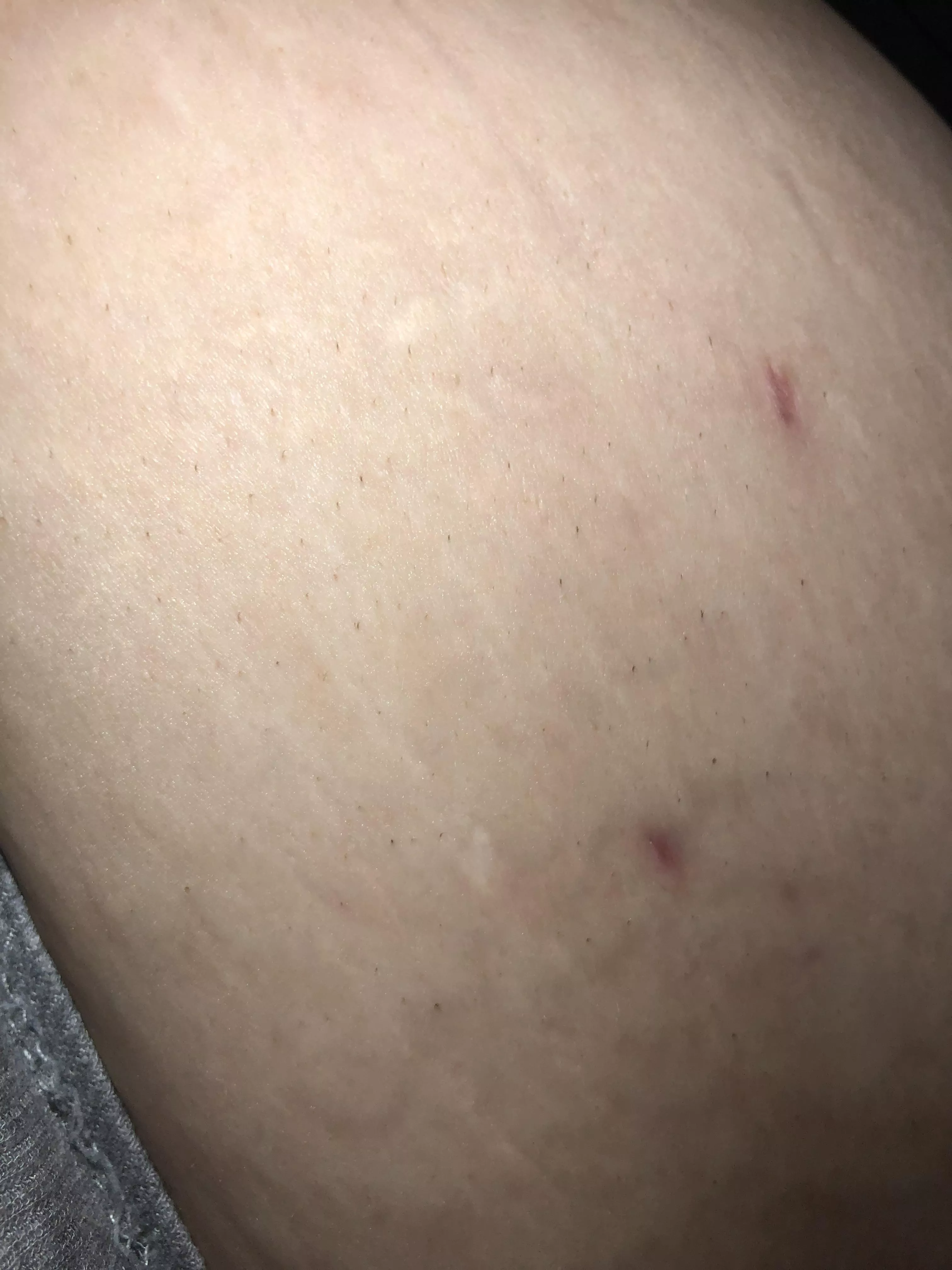 Does anyone know what these little hairs are? They don’t hurt to pluck and come out super easy. They’re on my sides and stomach occasionally. Worse on my sides though.