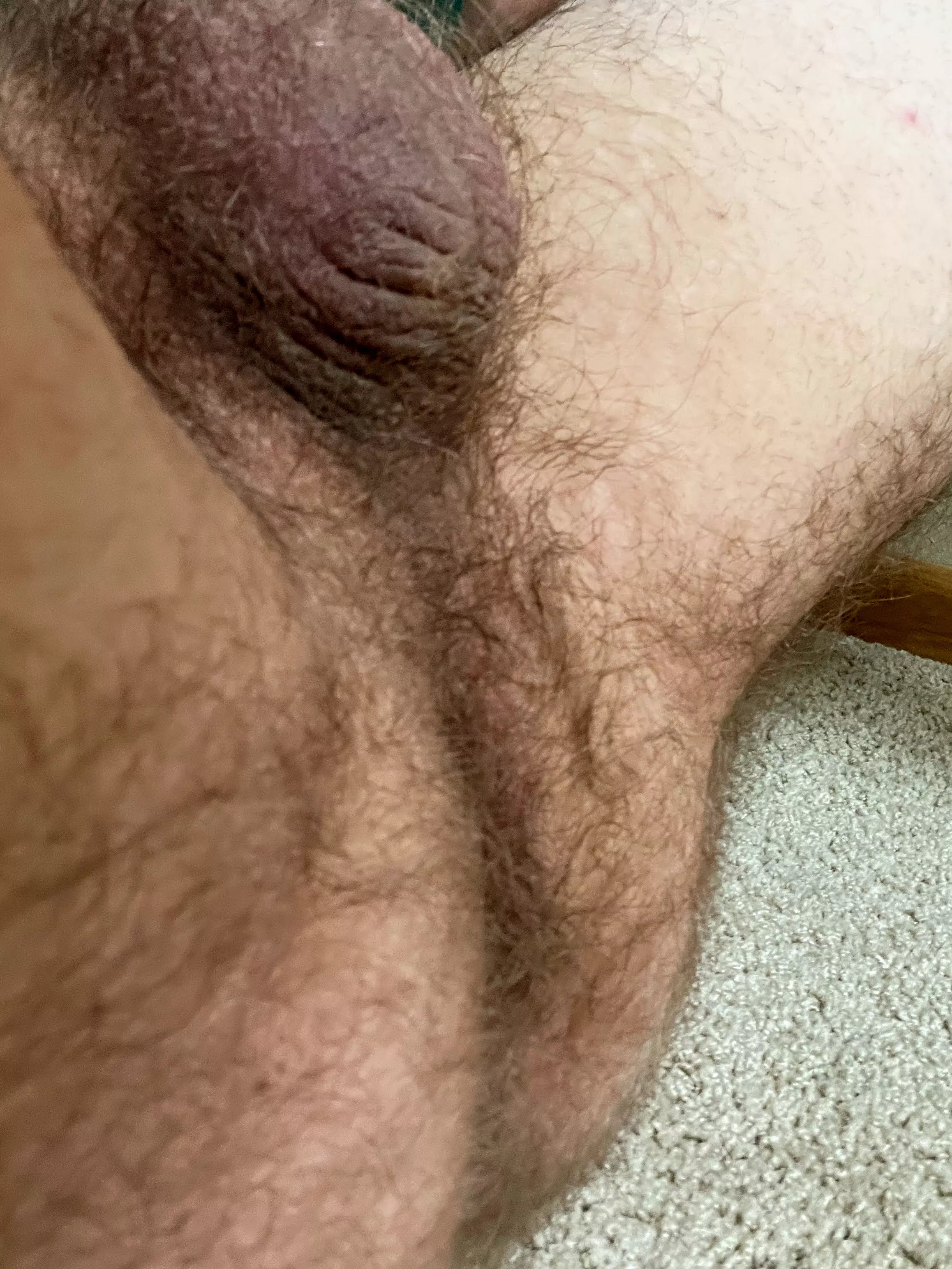 Does my ass qualify as insanely hairy?