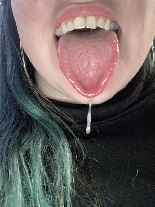 Drooling in a parking lot