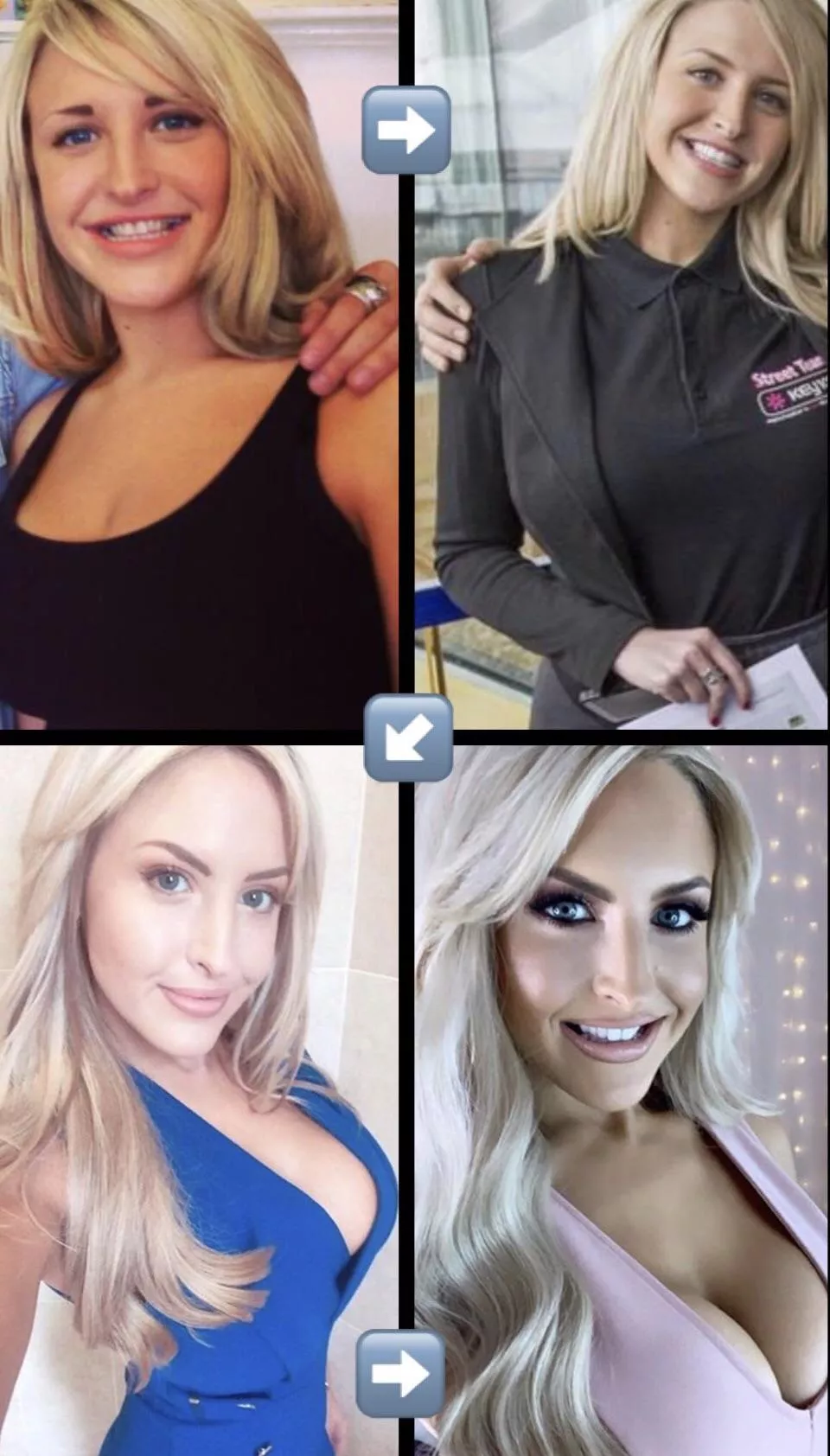 Emma Louiez Jones transformation.