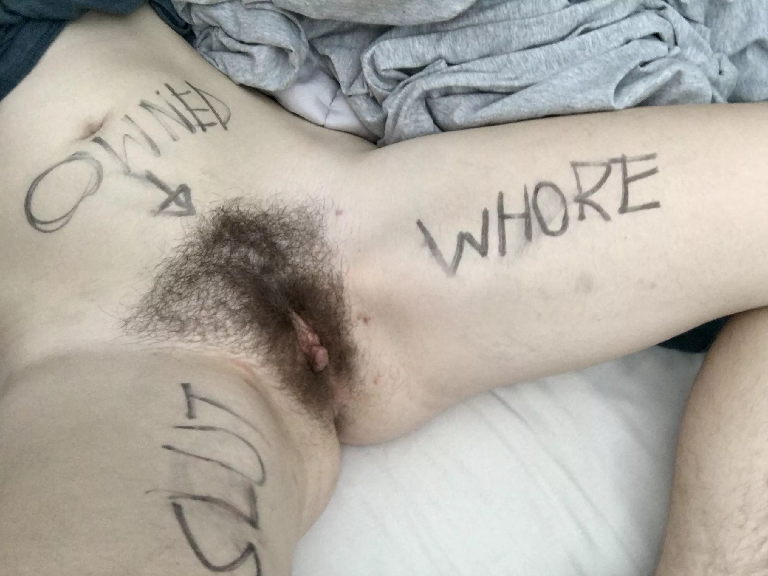 [F] Daily Post part 2