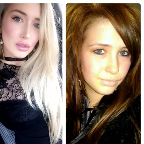 Facial b7mbofication progress???