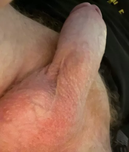 Fans of some pink ginger balls?