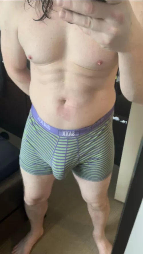 Feeling self conscious about my burn😢