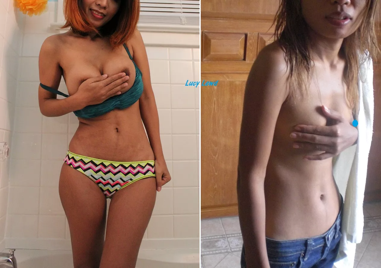 Finally got a boob job [f]