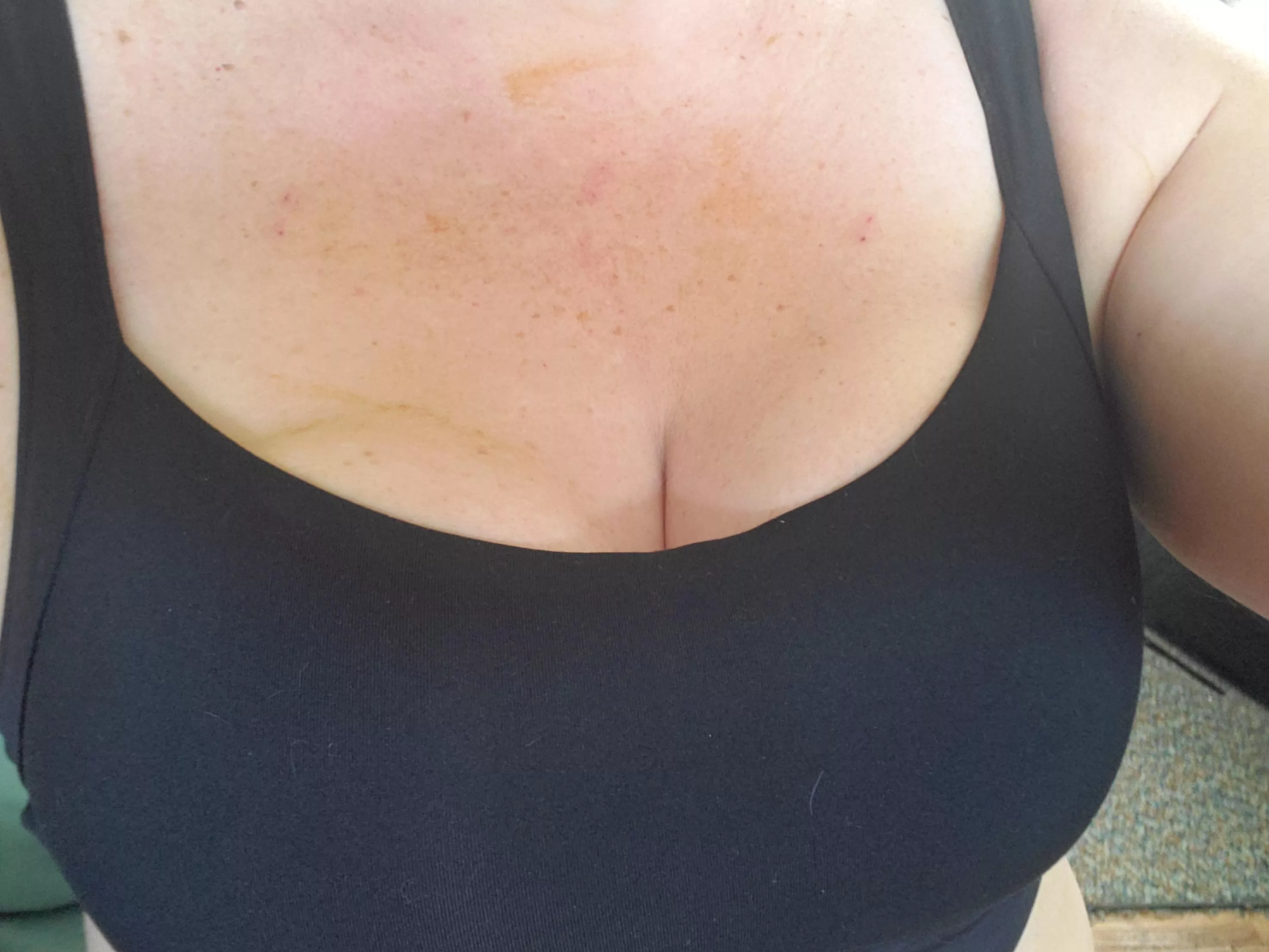 First time back in a sports bra after reconstruction