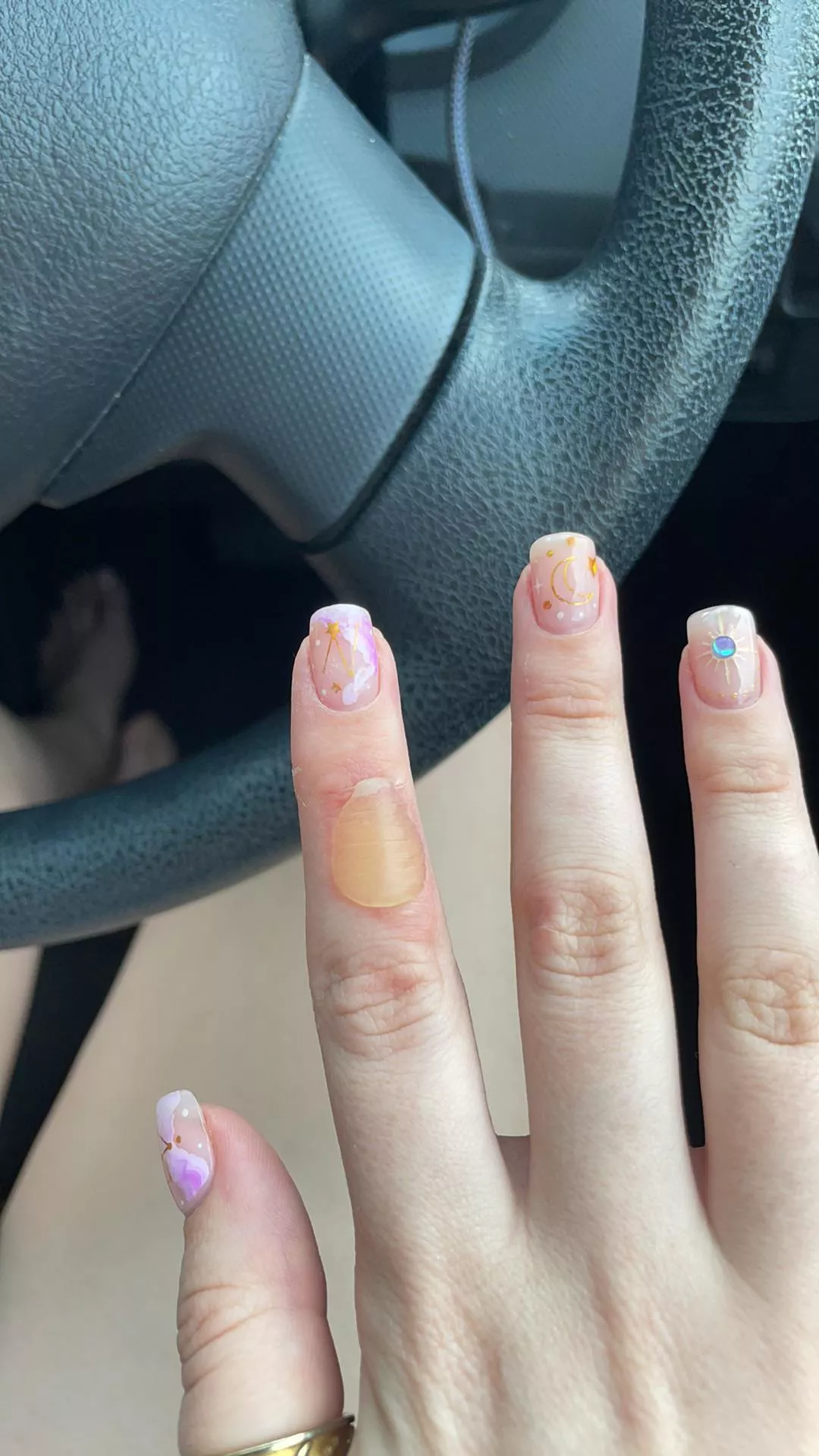 Forbidden burn pop - be careful when pulling plastic up from a microwave meal