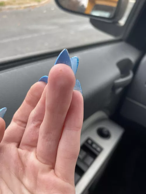 Forbidden pop. Dyshidrosis reminding me a flair up is just some stress away.