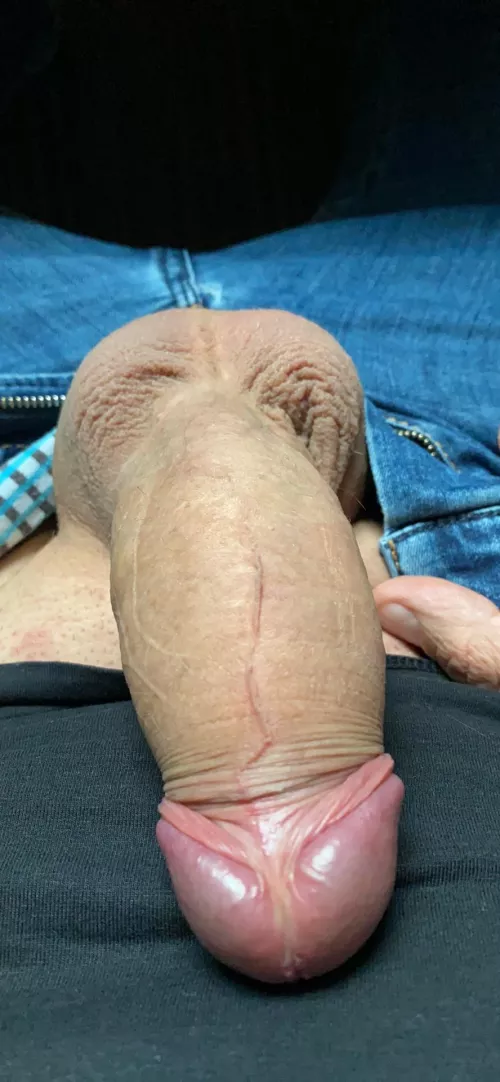 Foreskin down