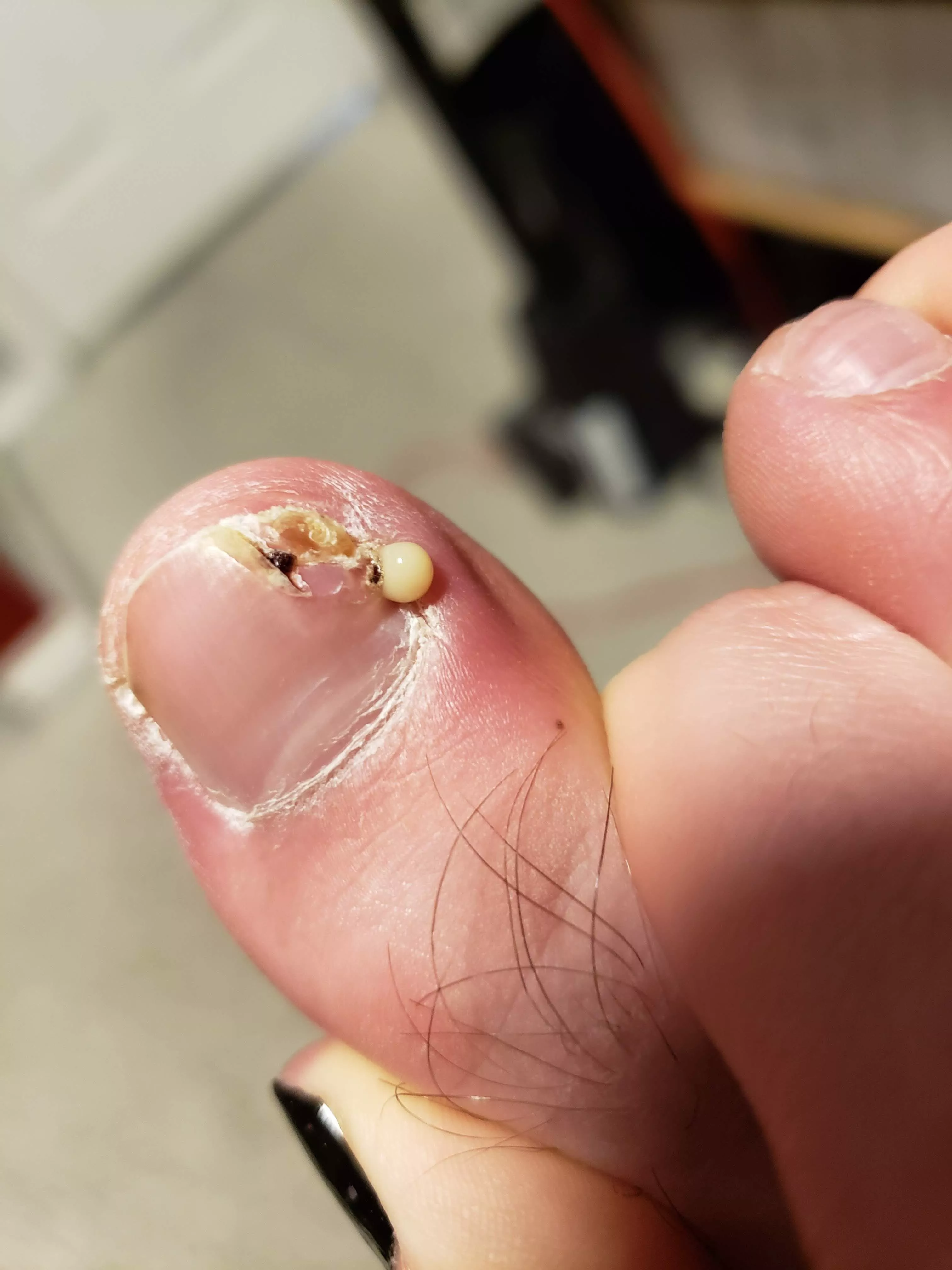 Found this fun little surprise while caring for an ingrown toenail from running a marathon. Made it all worth it