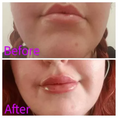 [F]oxie is starting her transformation....