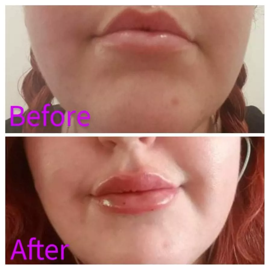 [F]oxie is starting her transformation....