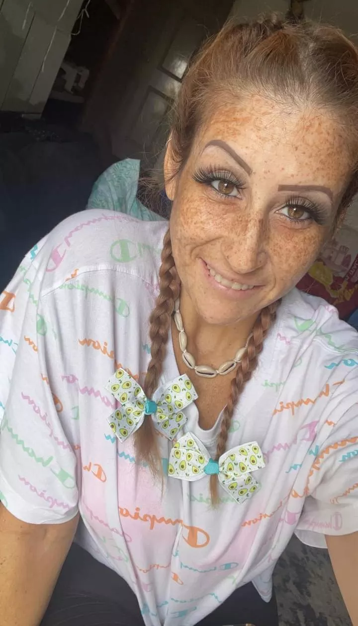 Freckles and pigtails 🔥🔥 Freckles and pigtails 🔥🔥