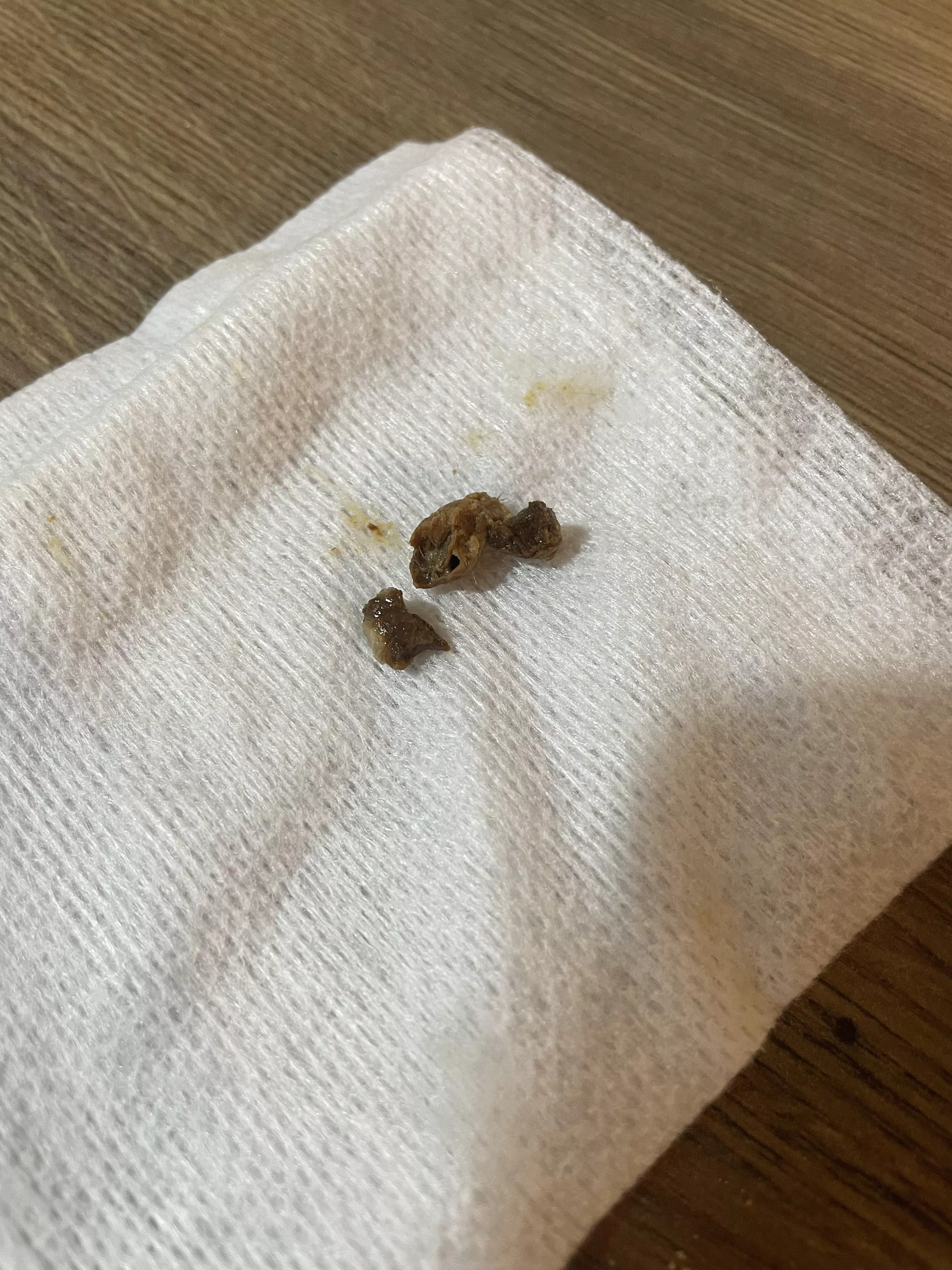 Giant glob of earwax extracted from my mums early. She was almost completely deaf before extraction