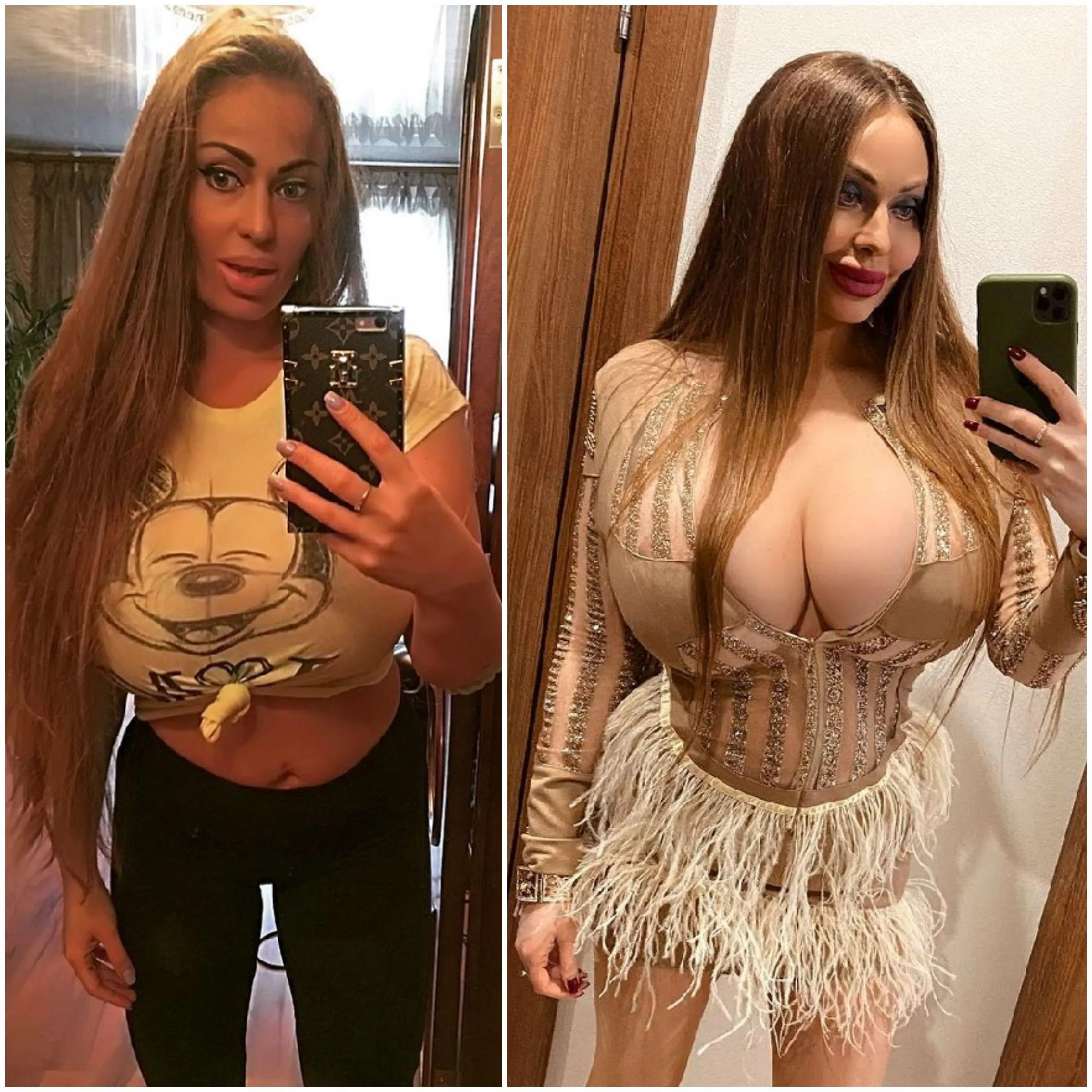 Girls should evolve all the time. Plastic makes them beautifull