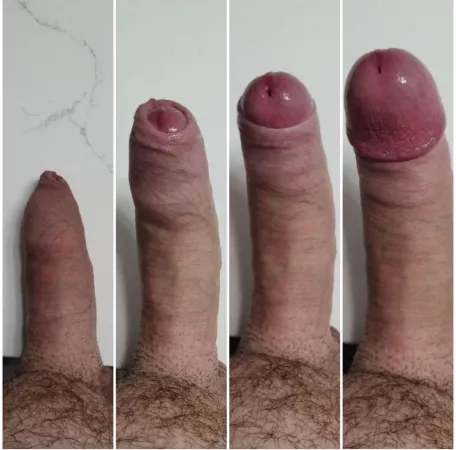 456px x 450px - Who likes my tight foreskin? ðŸ˜‹ðŸ˜‰ nudes by PhimoDick