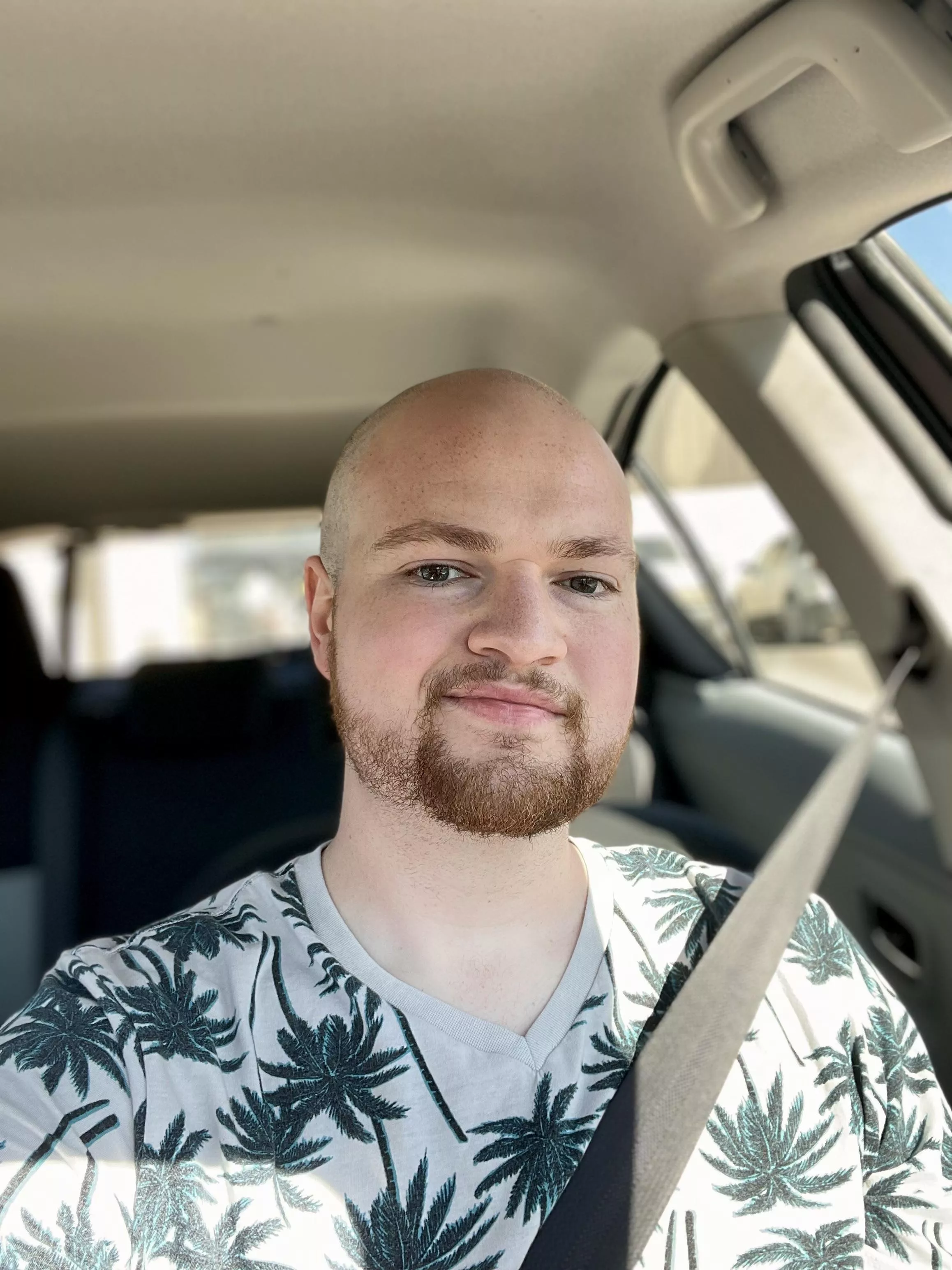 Got tired of thinning hair… finally got rid of it.