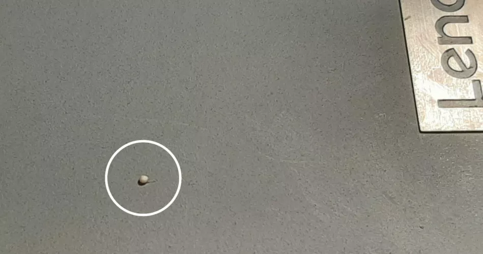 Had a painful Fordyce on by balls, popped one out and this little pebble came out.