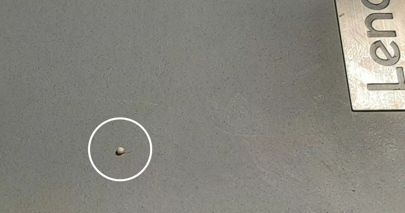 Had a painful Fordyce on by balls, popped one out and this little pebble came out.