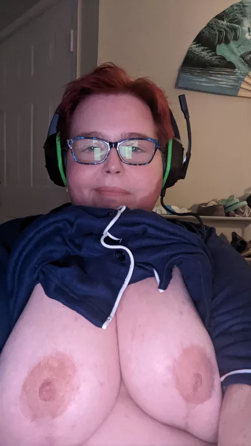 Had a reduction and need someone to massage them.