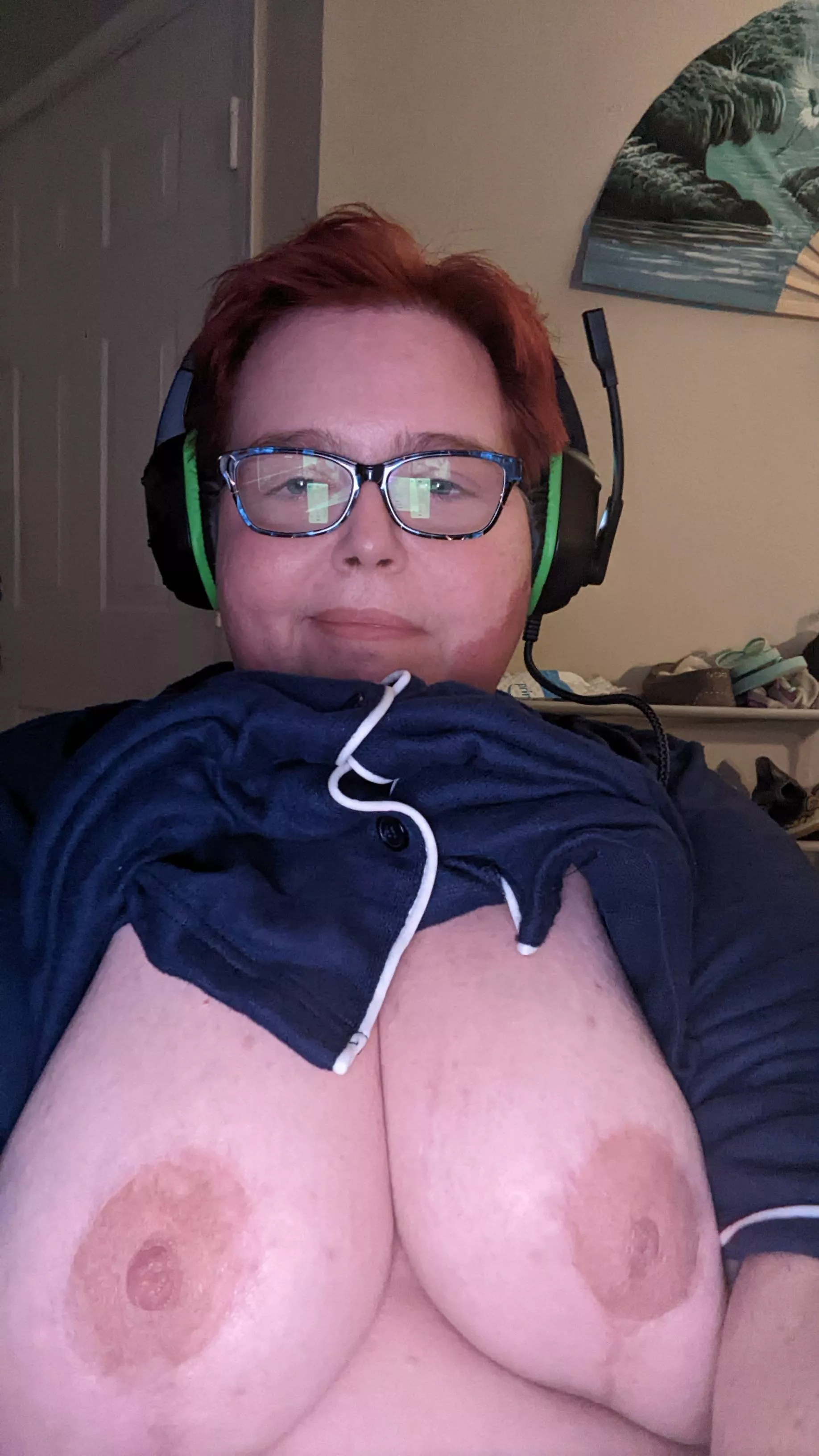 Had a reduction and need someone to massage them.