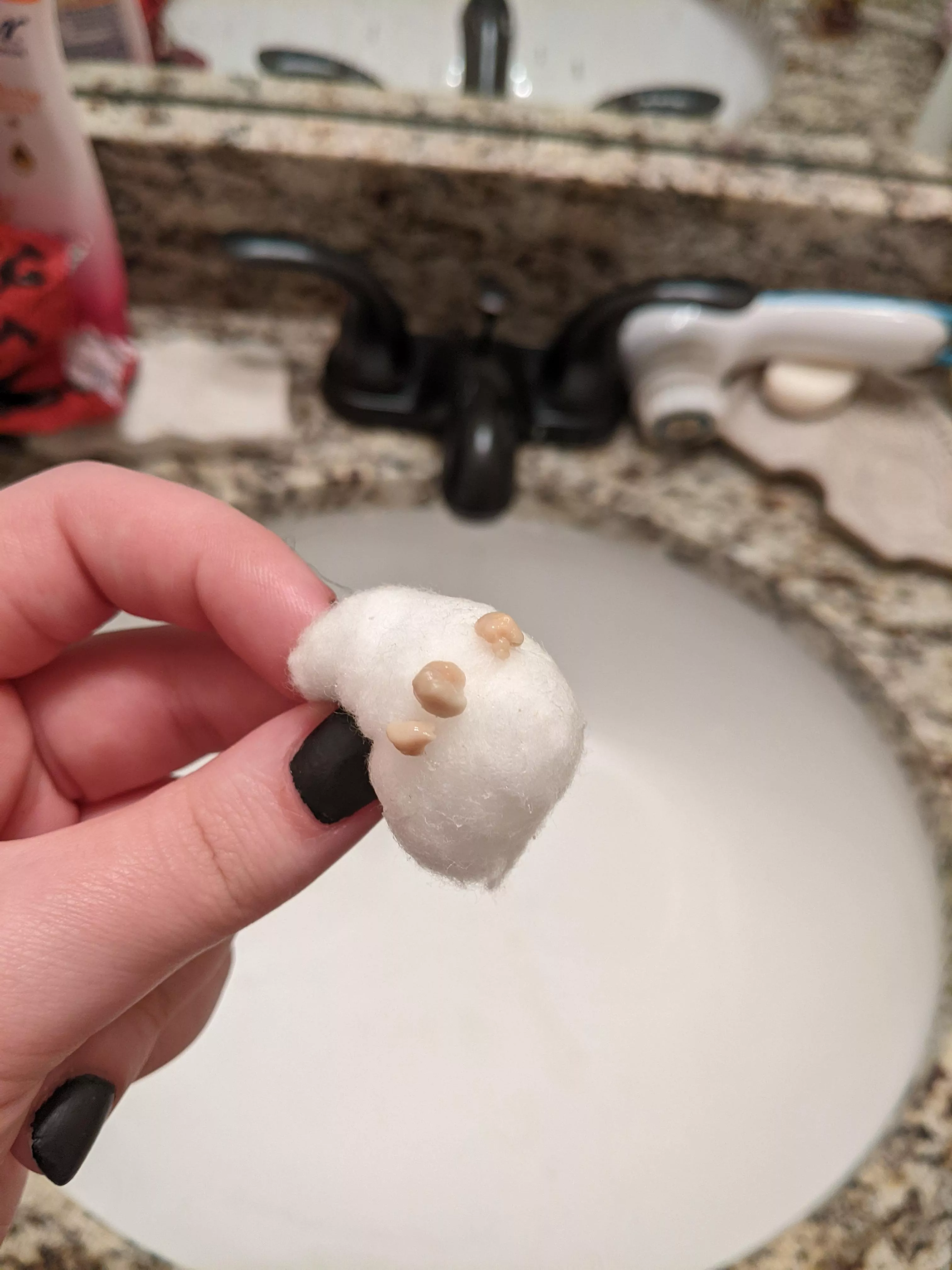 Had what I thought was one small tonsil Stone bothering me all day, finally got it out and it was three of them, thought y'all would want to see