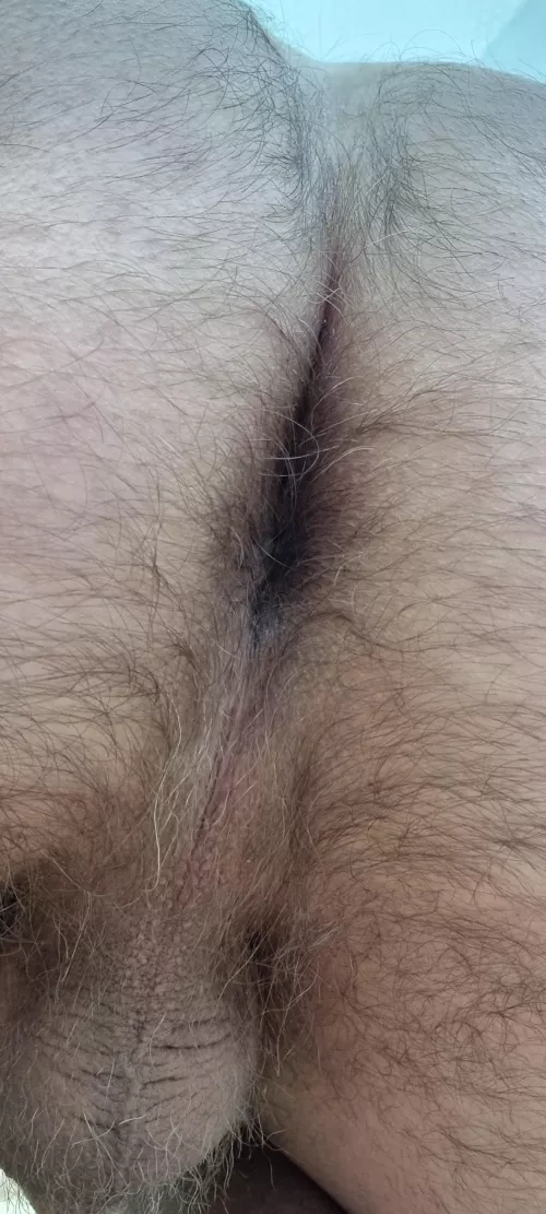 Hairy Christmas 🎄 hole, yes ?