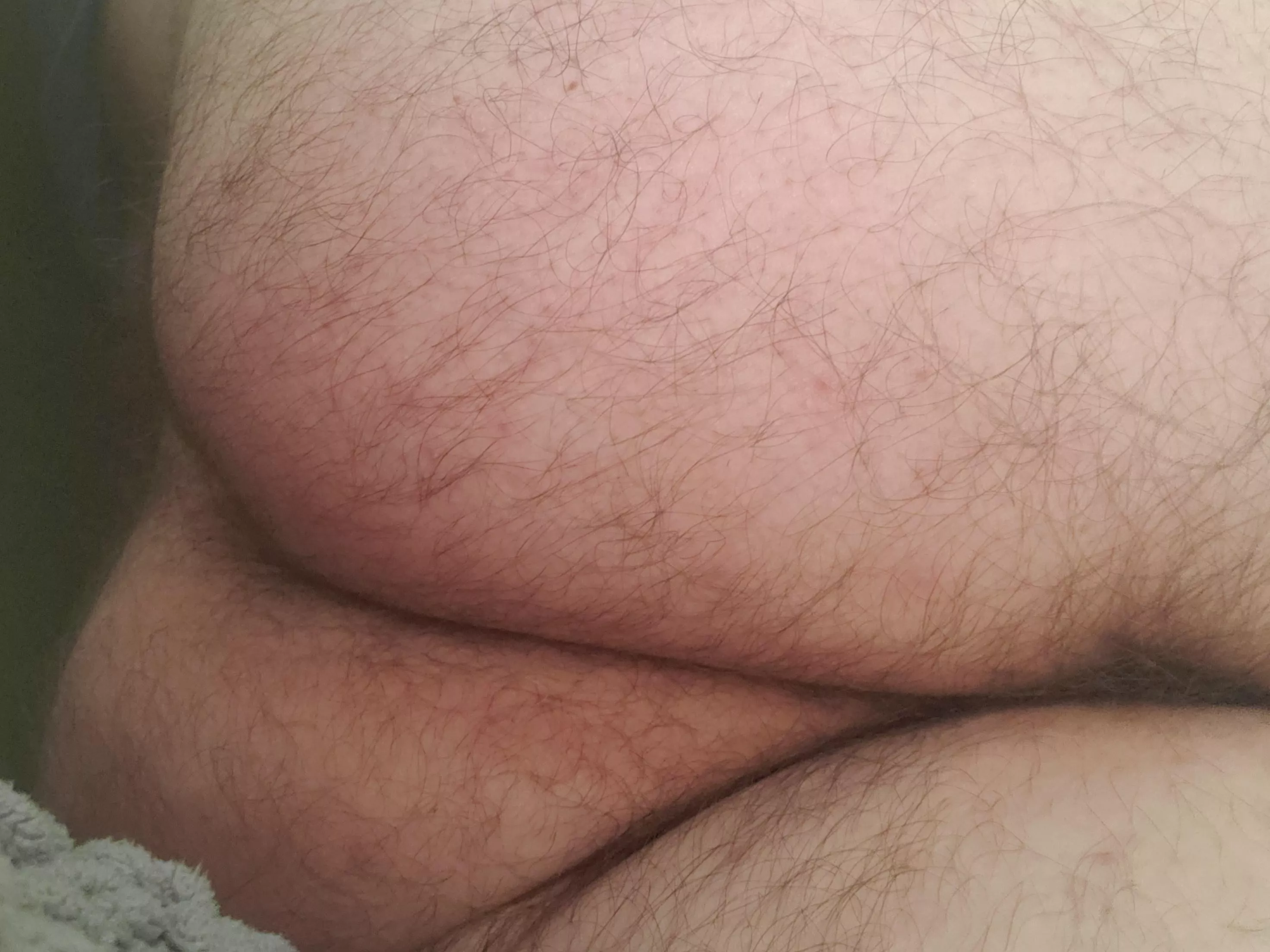 Hairy enough?