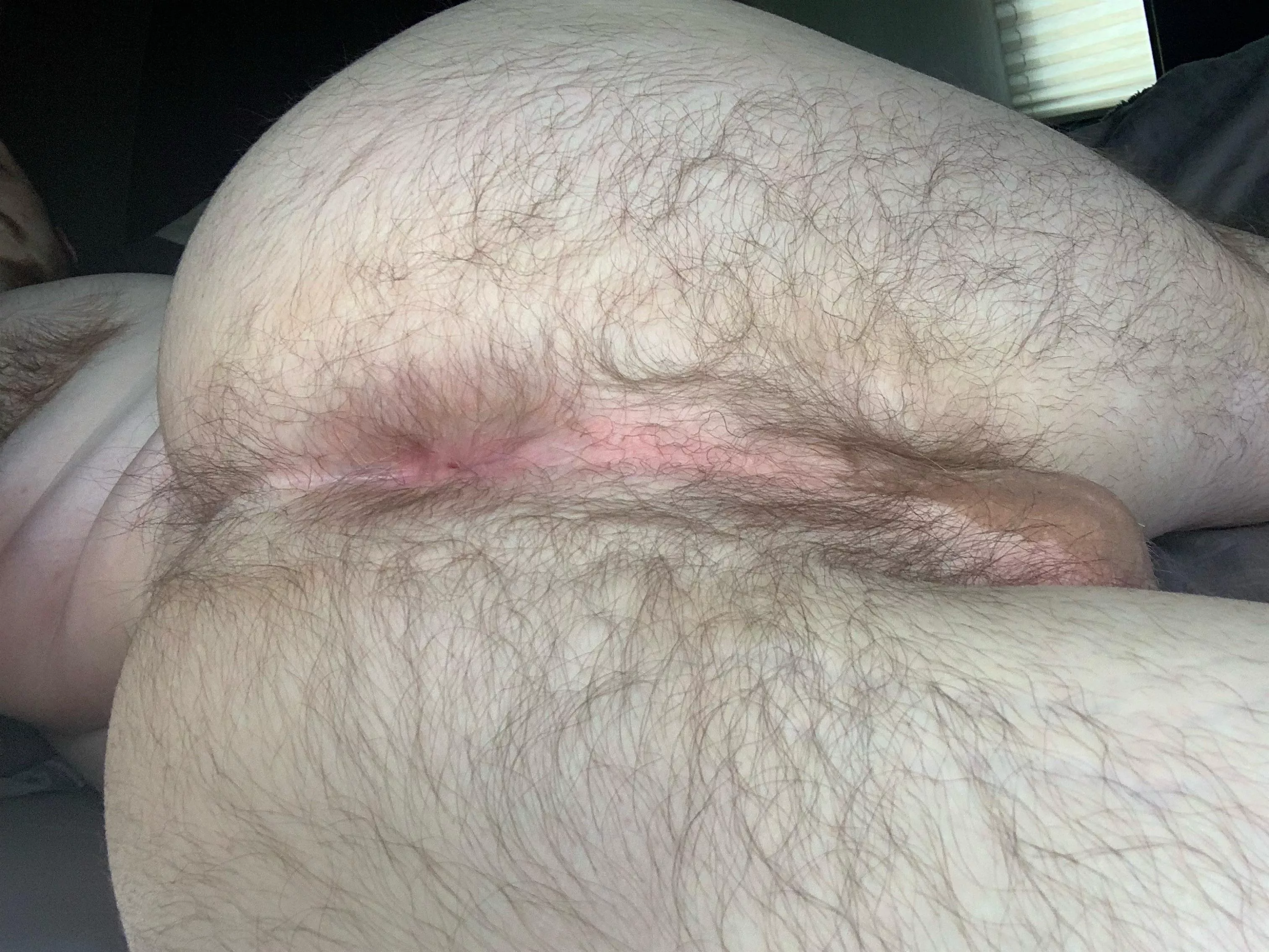 Hairy like nature intended