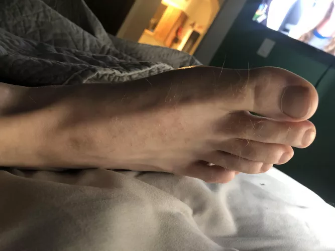 Hairy toes