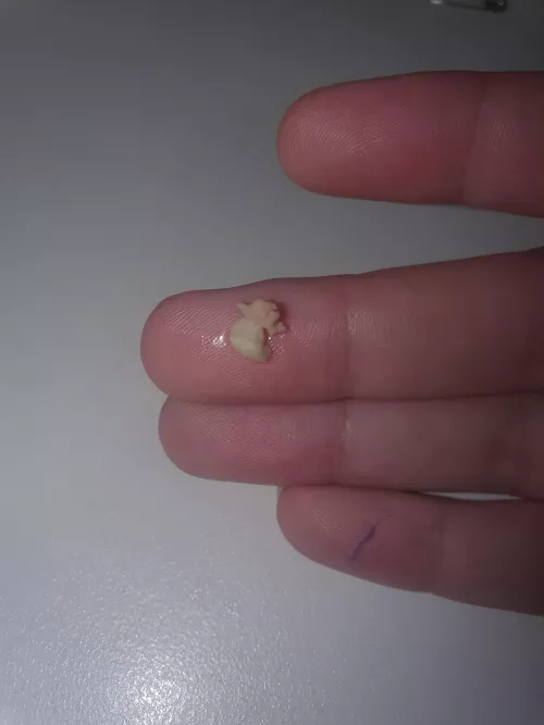 Have felt like there was a piece of popcorn in my throat all day, finally had a chance to check and this came out