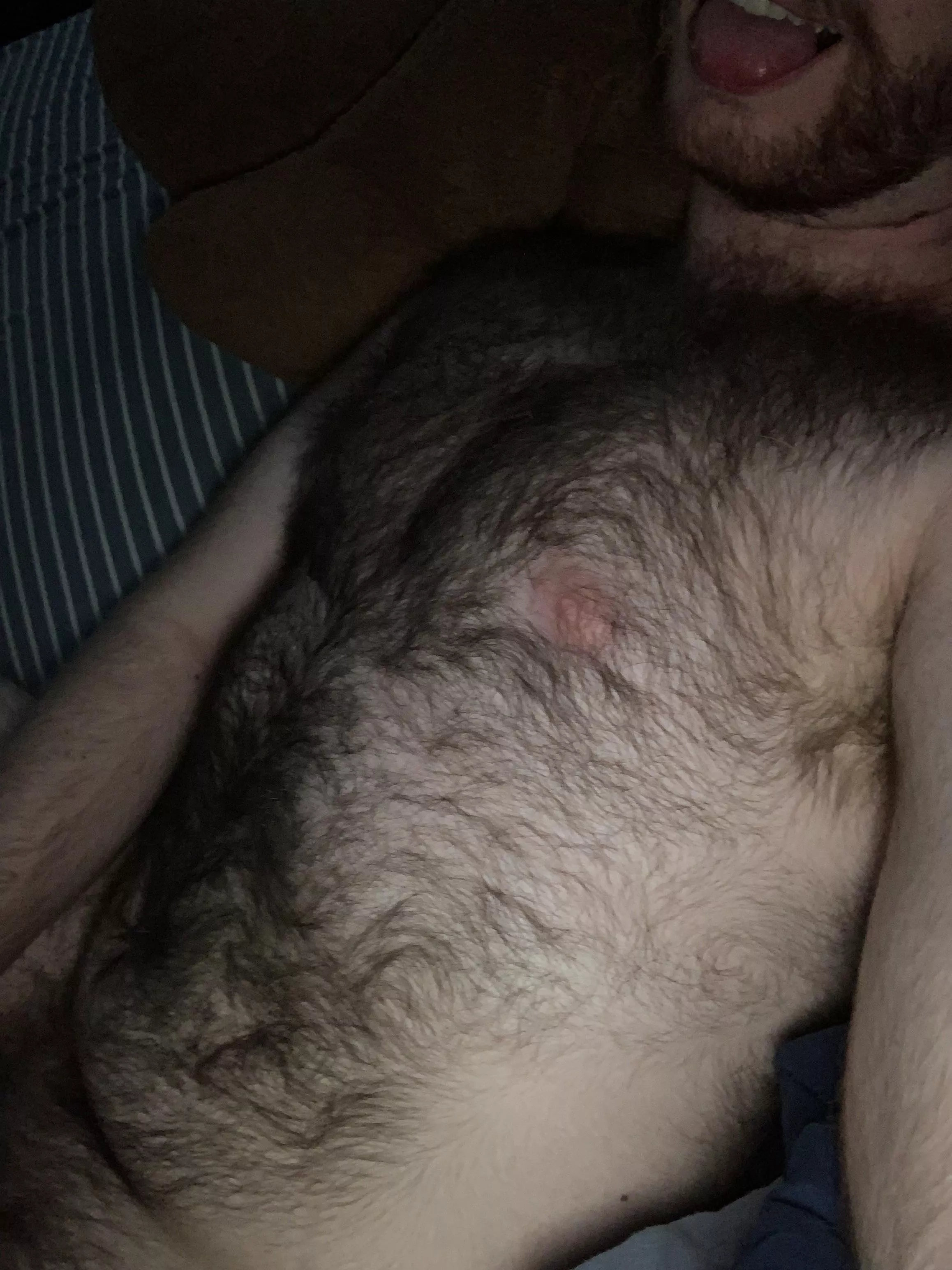 Haven’t trimmed in a while Haven’t trimmed in a while
