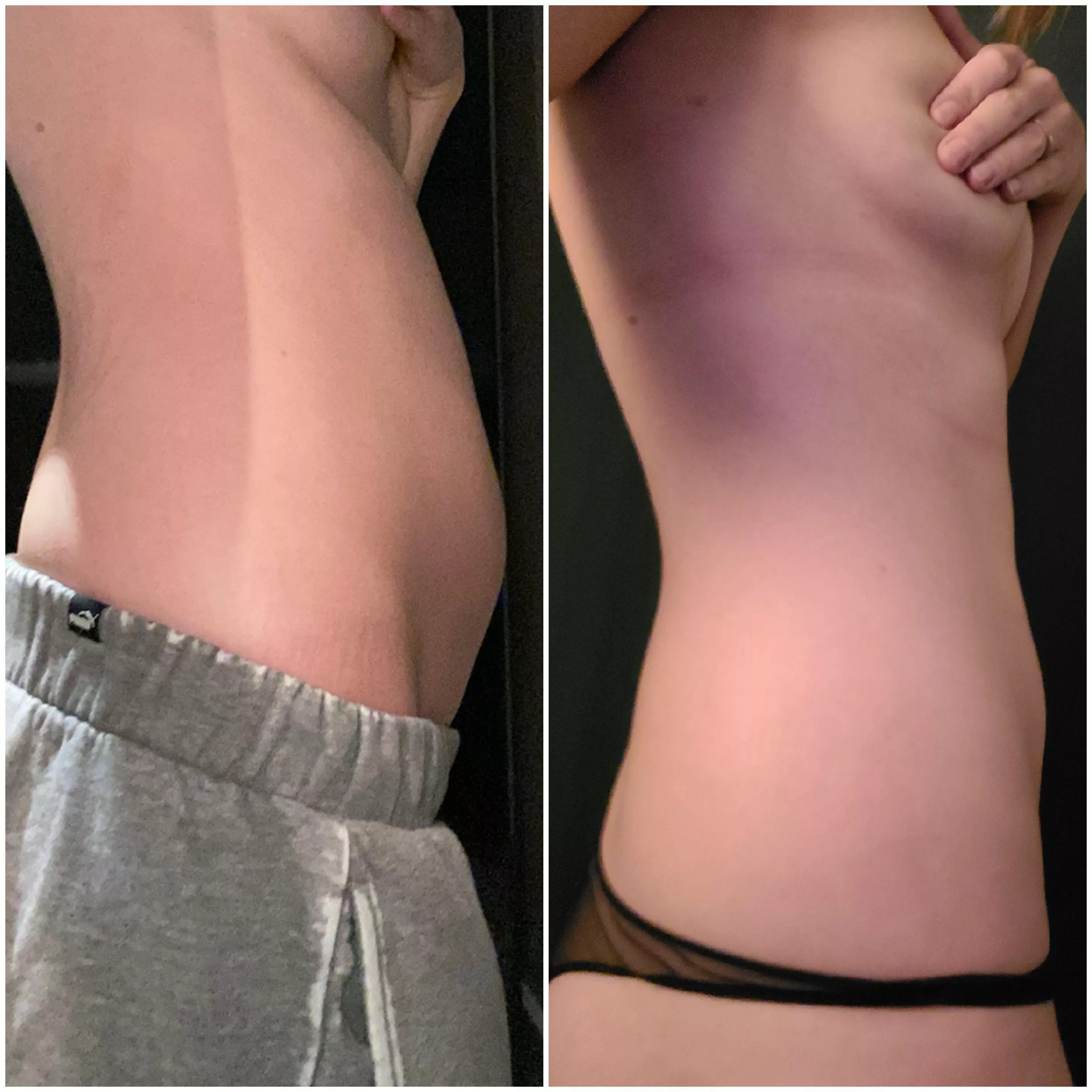 Help me gain! Less than 24 hours later 😭