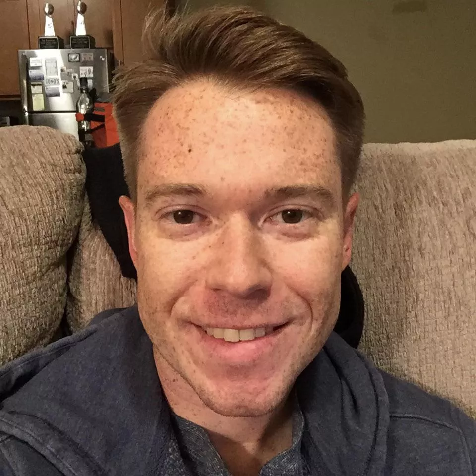 hey everybody! who likes freckles? π hey everybody! who likes freckles? π