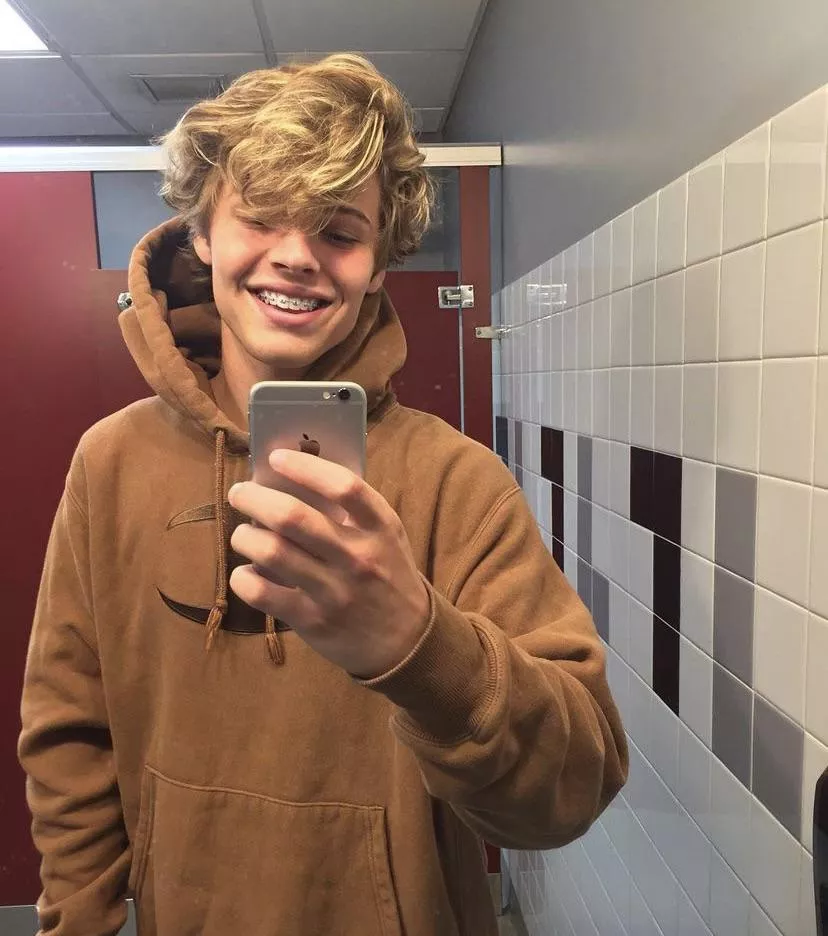 Hi! How you find my new braces? I think they don’t look good 😰😔